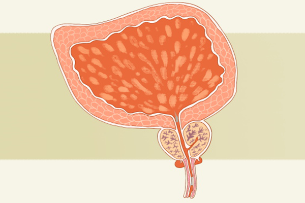 前列腺增生有什么症状