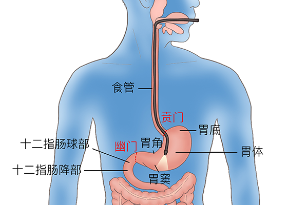 胃管怎么插