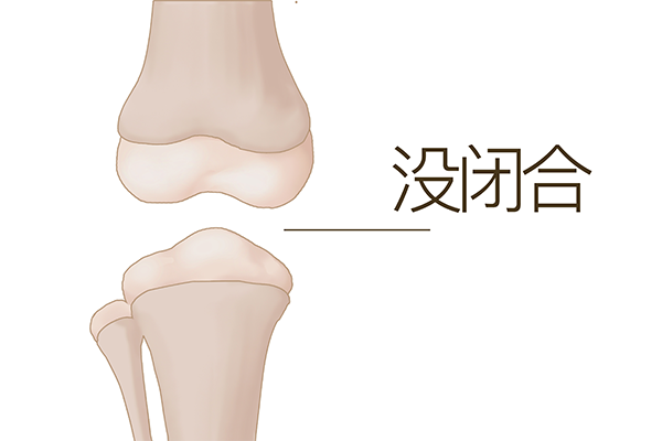 15岁还有必要测骨龄吗